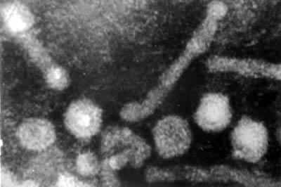 ���͸��ײ���������濹ԭ