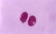 ��˿���ѣ���ϸ��