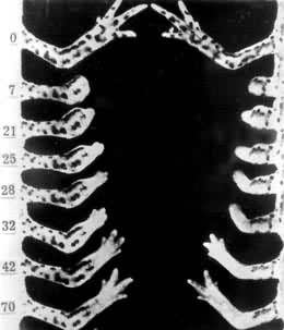 ͼ1�����֫�����±ۣ����ϱۣ��ң��жϺ�����������ͼ���������Ϊ��֫�������