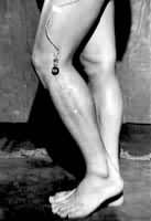 ͼ2���ؽڽǶ���