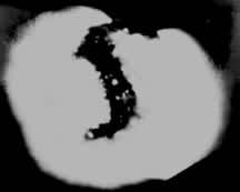 ͼ1  ��X�������㵽��1973��8��21�յ��ᶴ