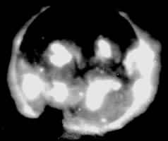 ͼ1  X��������