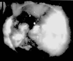 ͼ2  X�����ᶴ