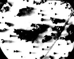 ͼ7  ΢��ʯ��ͼ��б����һ��ͷ����