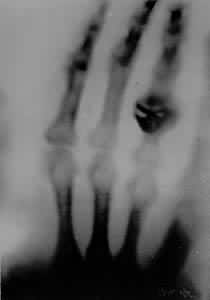 ����������������ֵ�X������Ƭ