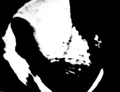 ͼ2 ����Ĵָ��Һ����ȫϢ�ؽ���