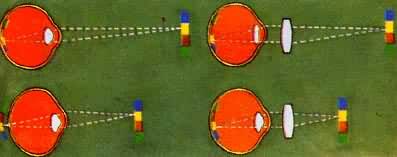 Զ���۵Ľ���