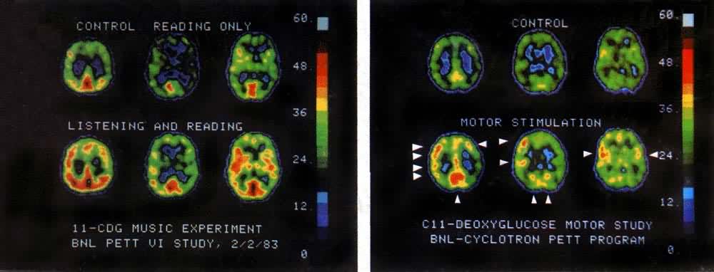 ���������ơ��˶��˷ܡ��Ķ��������ֵ�״̬���ڲ��������������ûͼ