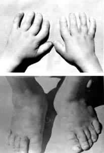 ��ǽڲ����ֽ�