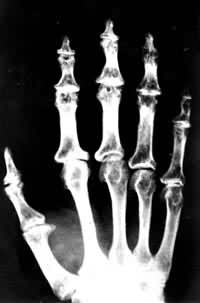 ���˴�ǽڲ��ֲ����ؽ�������Σ�Ϊ��ͯ�����ǻ����������Ĺؽڻ���