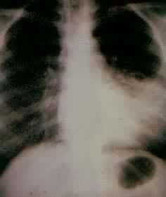 �����Է���