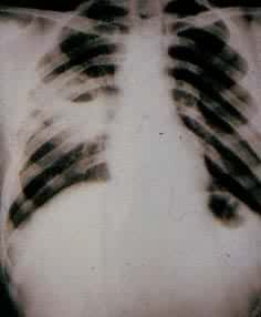 ��ŧ�ף���λ��