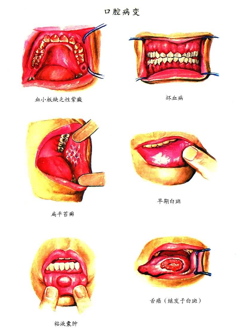 ��ǻ����