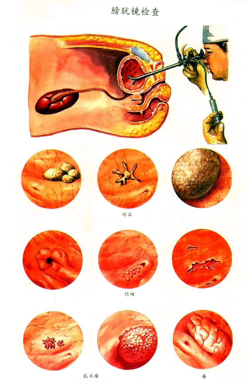 ���׾����