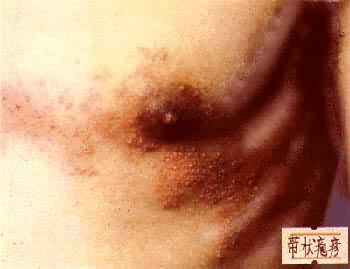 ��״����