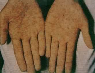 ÷��������