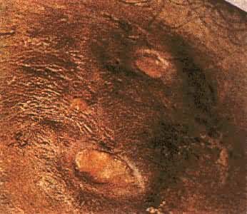 �����Բ�