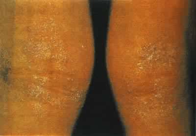 ��λ��Ƥ��