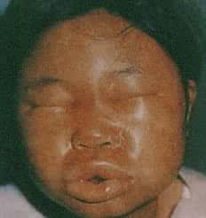 ʳ���������ճ���Ƥ��