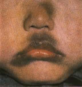 �̶���ҩ��