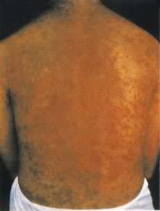 ʪ����ҩ��