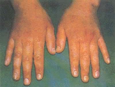 �����������Ժ��