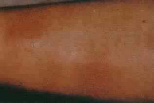 ����Ժ��