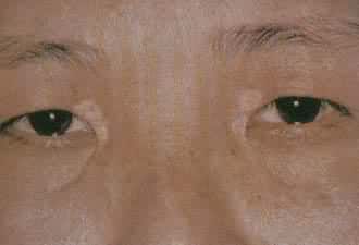 ������ɫ��