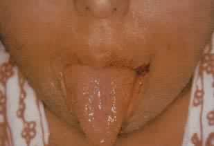 �˻���ȱ��֢