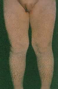 �������۲�