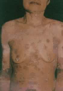 Ѱ�����崯