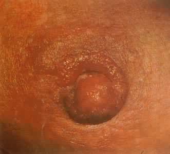 �鷿�弪���ϲ�