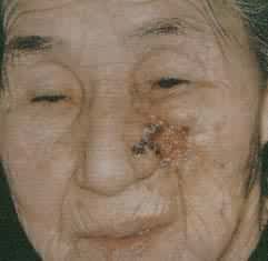 ����ϸ����