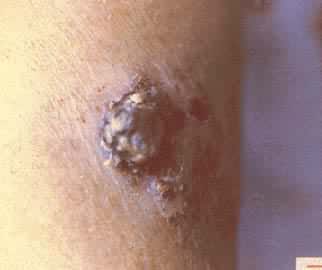 ��״��Ƥ��