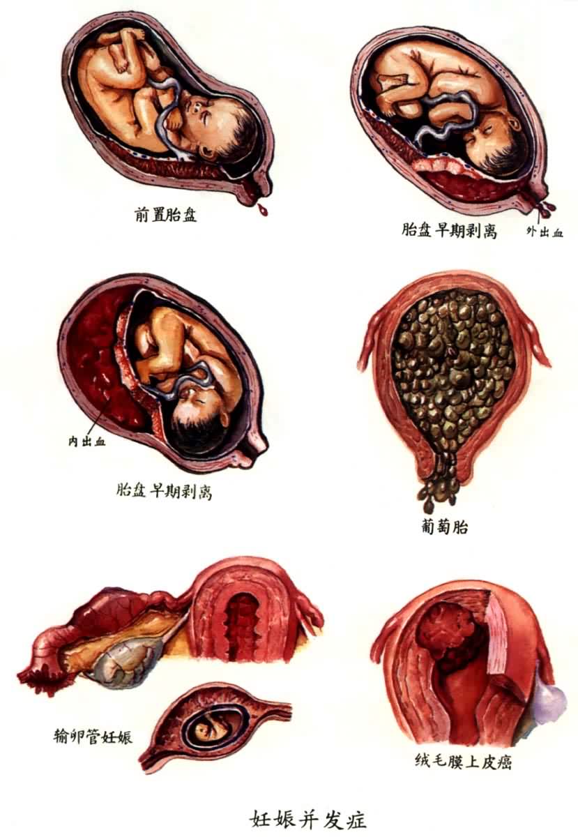 ���ﲢ��֢