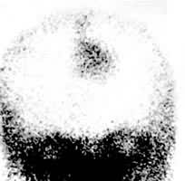 ��������Ӱ��ǰλ����������򿿽����ߴ��������쳣Ũ��