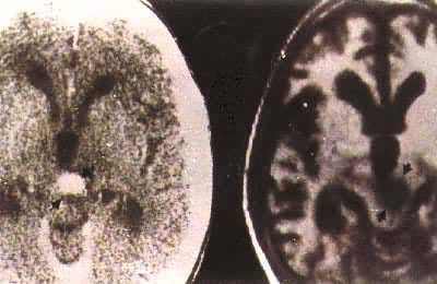 ���Խ�������CT+MRI��