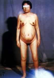 �������ۺ�֢