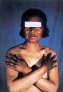 ������Ƥ�ʹ��ܼ���