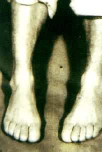 ֫�˷ʴ�֢���㣩