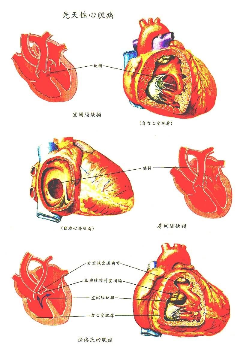���������ಡ