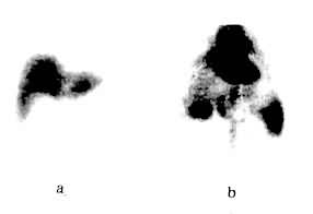 ͼ�����κ���״Ѫ����Ӱ��a��Ӱ��������������Լ���b��Ѫ��Ӱ�����������Լ�����������������Ũ