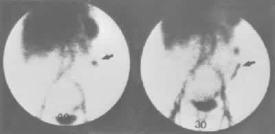 ͼ���������������ѪӰ��