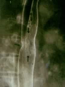 ʳ�ܰ����磩