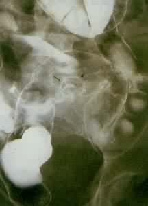 �᳦�����磩