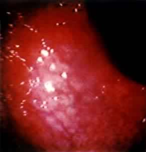 θ�ף�θ����