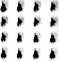 ͼ3 �Ķ�����ϵ��Ѫ��Ӱ��