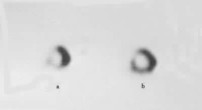 ͼ5 �ļ�ȱѪ�Ĺ�ע��˸���� a�˶������� b��Ϣ3Сʱ��