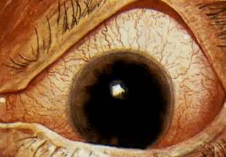 ����ۣ����Գ�Ѫ�ԣ�