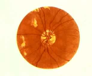 ��Ѫѹ��������ˮ�ס���Ѫ��